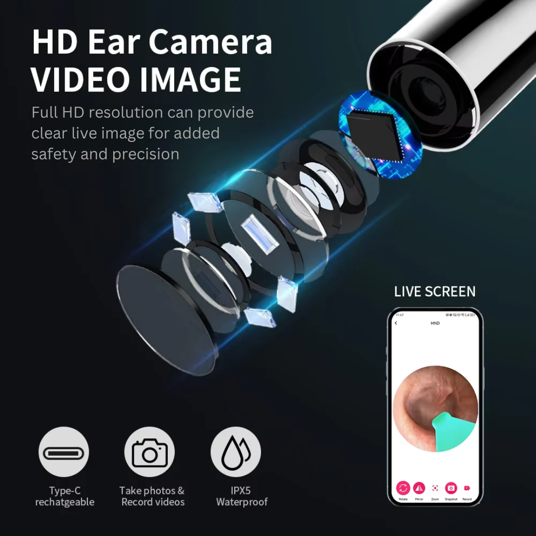 Earely Smart Ear Cleaner with Camera Set HD Ear Sticks Otoscope USB C Charging Endoscope Wax Removal Tool Earpick Ear Cleaning Set NK3 Pro - Earely